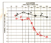 Graph of hearing test