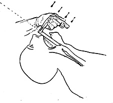 Grayscale sketch of a doctor performing a direct laryngoscop