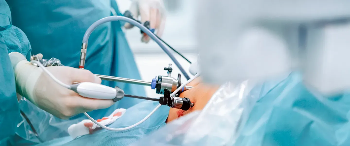 Laparoscopic Surgery_doctors performing Laparoscopic Surgery