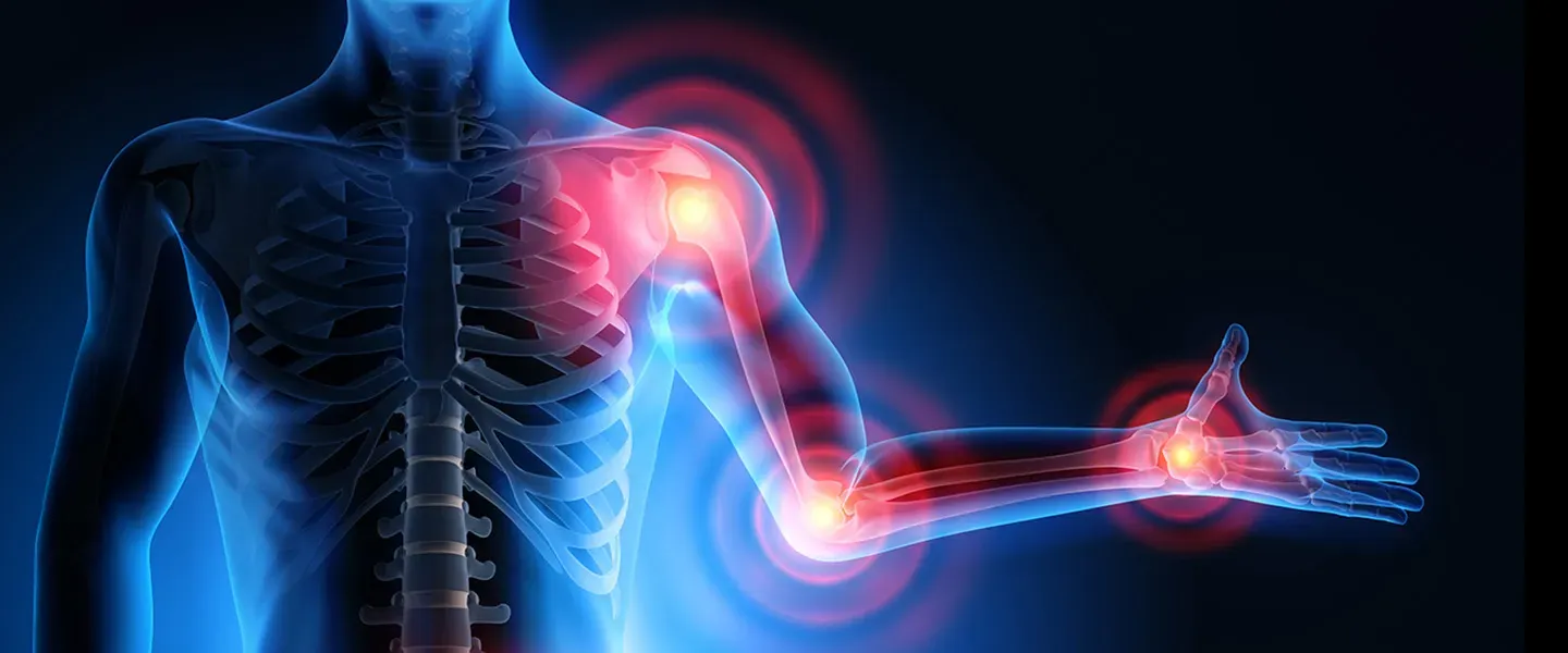 A graphic shows a blue outline of a male skeleton with red h