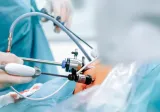 Laparoscopic Surgery_doctors performing Laparoscopic Surgery